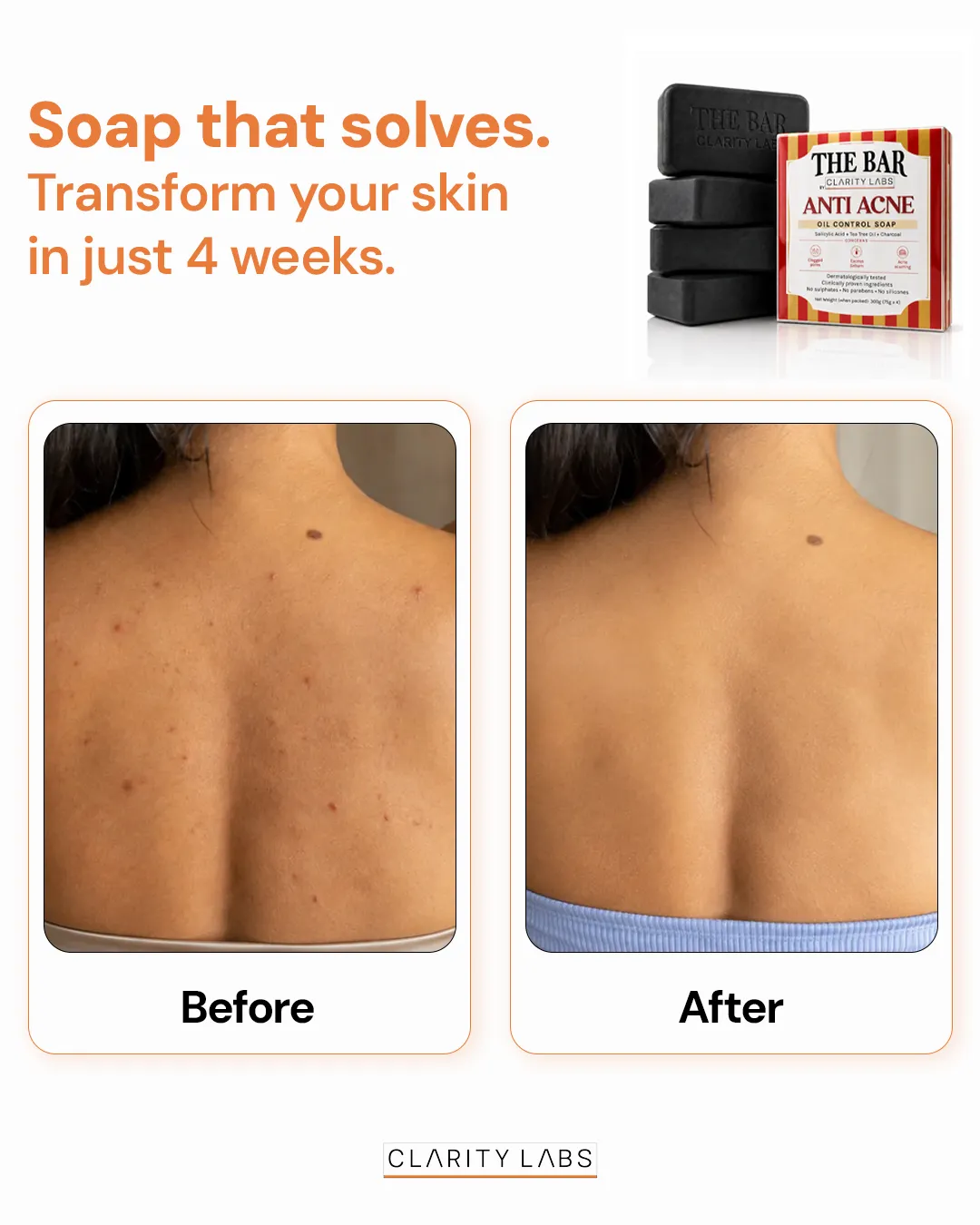 Skincare static ad: "Transform your skin in just 4 weeks."